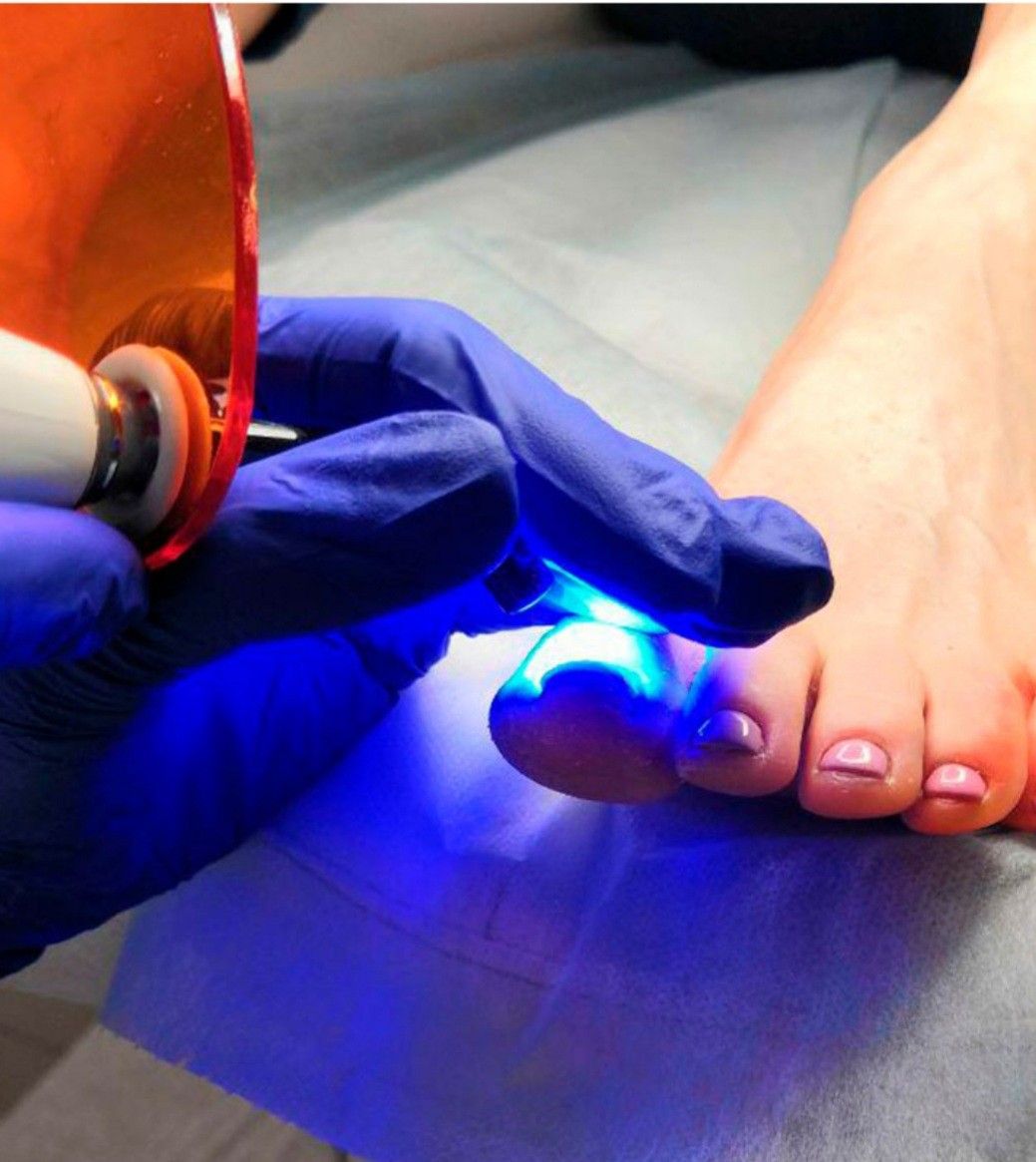 Pedicure Clínico en Bogotá - Pisadas Sanas Spa Usaquén